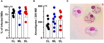 MicroRNAs regulating macrophages infected with Leishmania L. (V.) Braziliensis isolated from different clinical forms of American tegumentary leishmaniasis